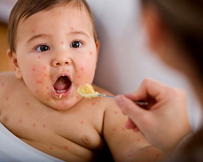 Cho trẻ ăn thức ăn mềm, dễ tiêu hóa khi bị  bệnh tay chân miệng
