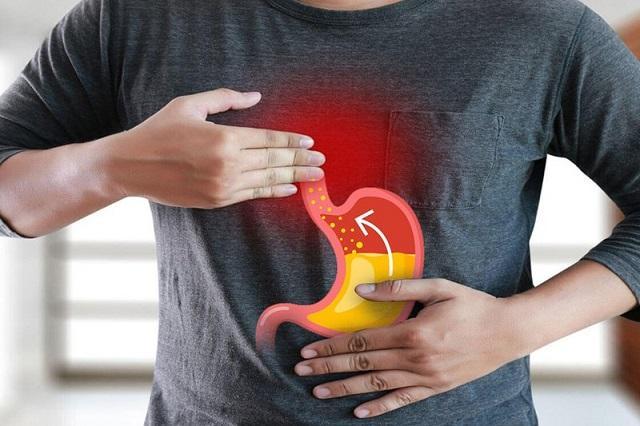 Trào ngược dạ dày thực quản: Nên ăn gì và kiêng ăn gì?