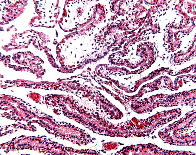 Villous tissue of the aye-aye placenta