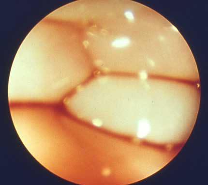 Close-up view of a few square centimeters of canine vaginal mucosa obtained during proestrus using a fiber optic endoscope