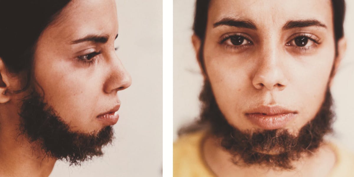 Ana Mendieta, Untitled (Facial Hair Transplants), 1972. Photo © Phillips (detail)
