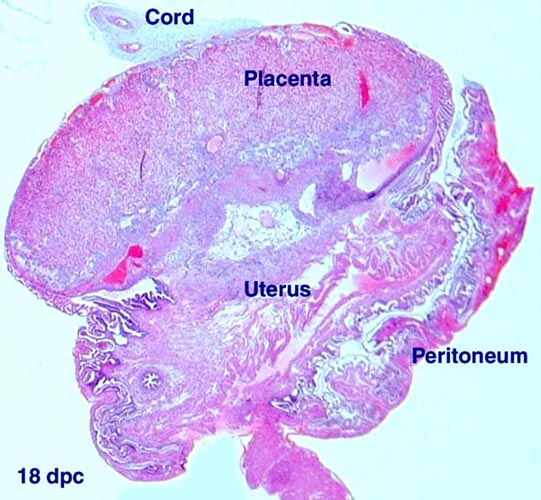 Implanted placental disks near end of pregnancy