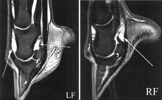 These are sagittal STIR images from two horses; one horse had increased fluid in the distal interphalangeal joint (left), and another horse had increased fluid in the navicular bursa.