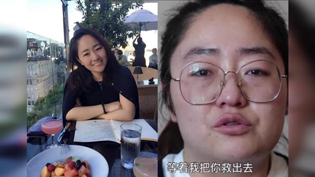 回國後經歷各種壓力之後的王然已十分憔悴。(王然社交帳戶圖片 / 拍攝日期不詳)