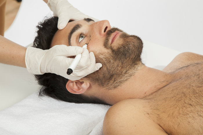 Tratamientos estéticos para hombres contra la flacidez facial