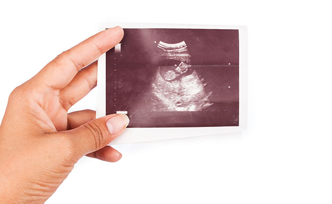 Keluhan & Tips pada Trimester Pertama Kehamilan