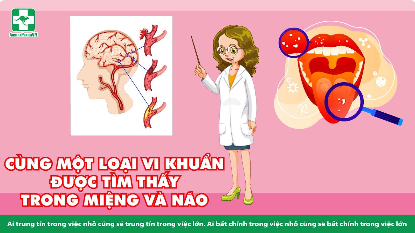 VỆ SINH RĂNG HẰNG NGÀY CÓ THỂ GIẢM NGUY CƠ BỆNH ALZHEIMER