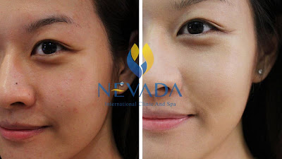 Chăm sóc gia hoàn hảo với Luxy Skin