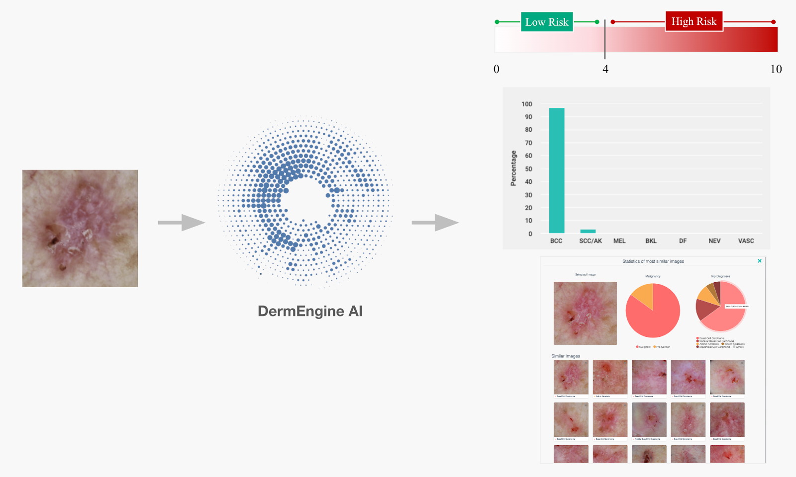 DermEngine AI Artificial Intelligence