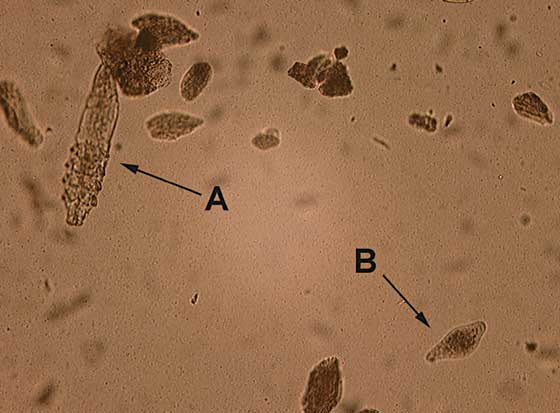 Demodex canis (A) mite and (B) egg (original magnification x100)