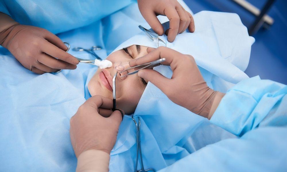 Everything You Need To Know About Rhinoplasty