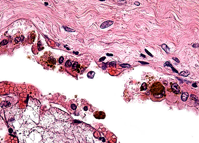 The pigmented trophoblast below the chorion, in trophoblast