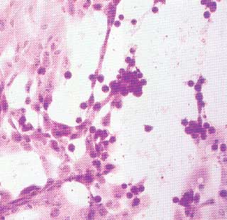 Efeito citopático de um herpesvírus equino "lento". Cortesia do A. Wayne Roberts..