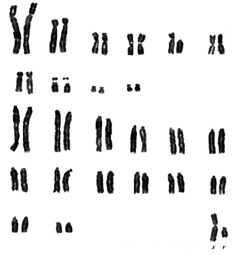 Karyotype of male Alouatta seniculus sara, 2n=50 from San Diego Zoo