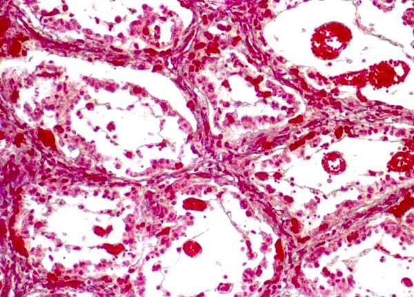 Cross section, stained with Mallory connective tissue stain