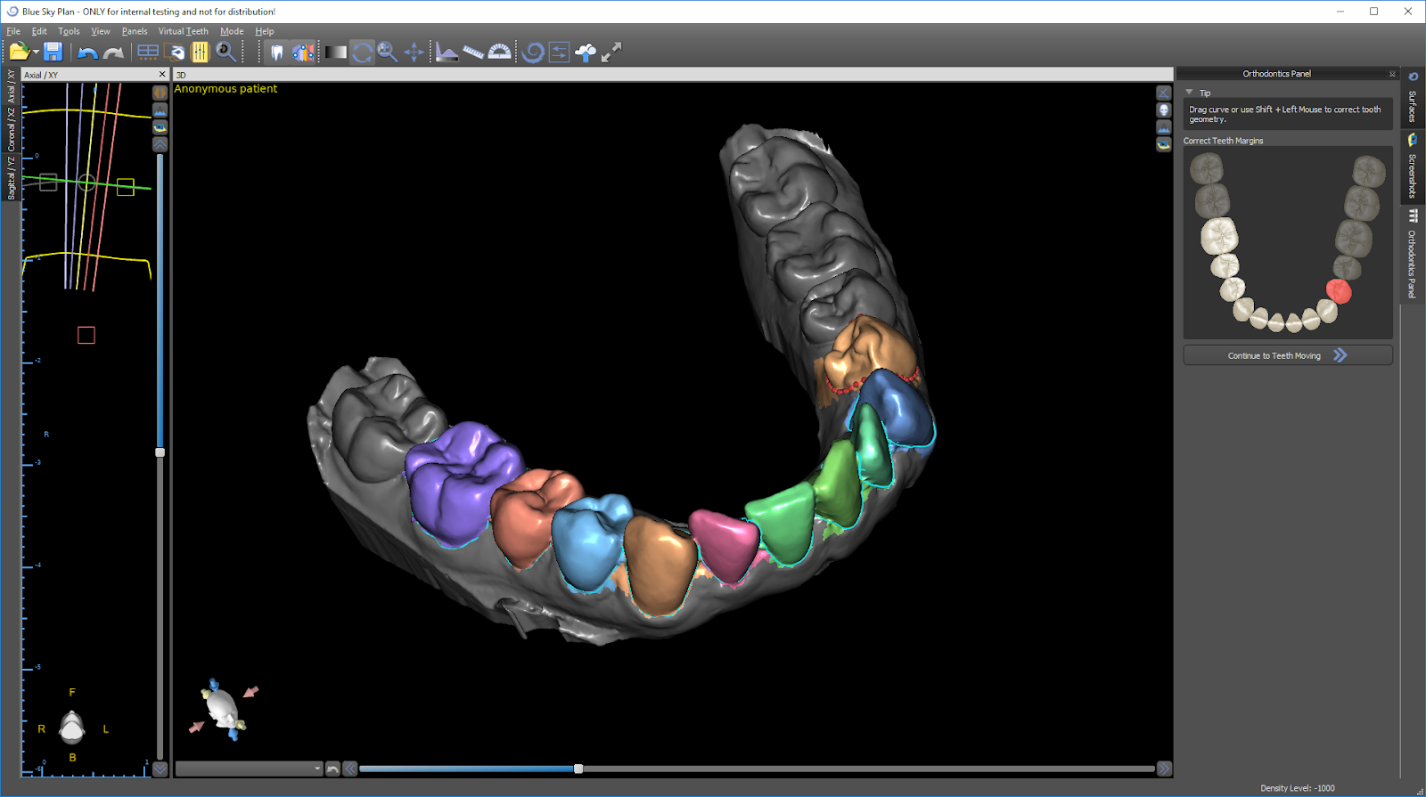 Blue Sky Plan Orthodontic Tooth Selection Process
