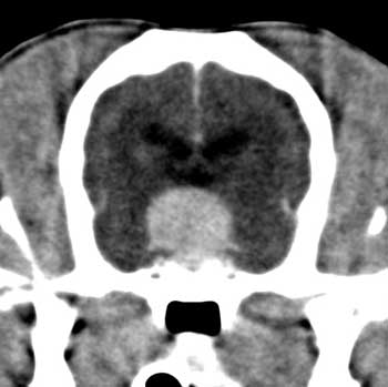 Post-contrast, transverse CT image of a dog with pituitary macroadenoma