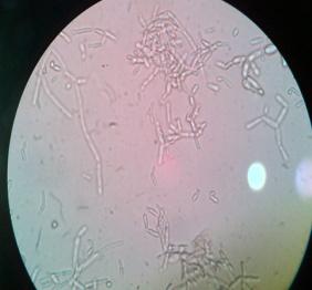 F:\GAMBAR percobaan 7\gambar kedondong\kedondong khamir 15% 30g 10x100.jpg