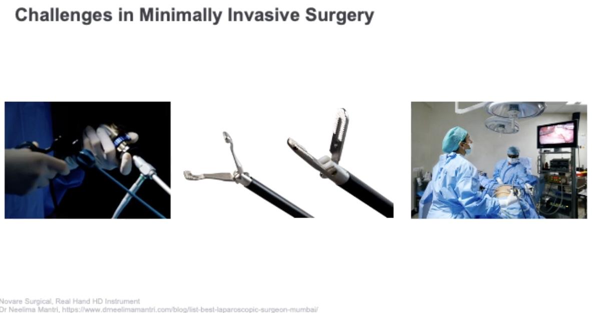 Challenges of minimally invasive surgery