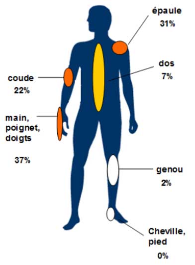 Répartition par localisation des TMS reconnus en maladie professionnelle