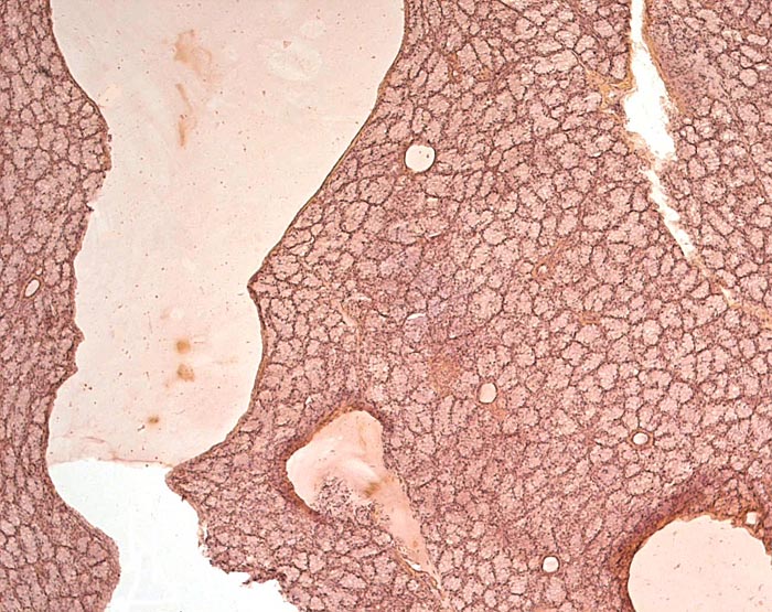 Salivary gland of Malayan pangolin with distended duct.