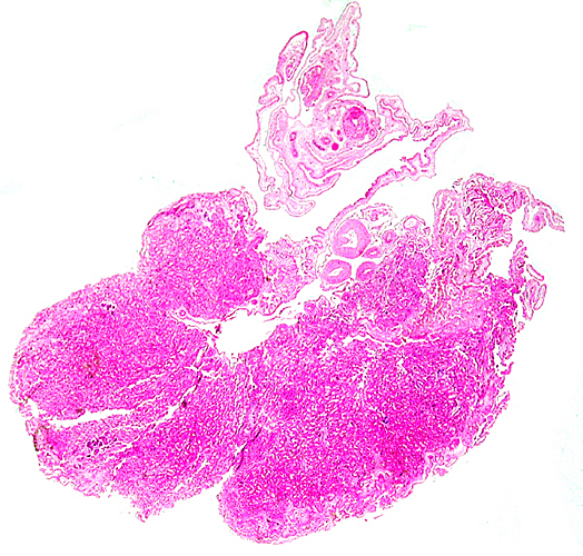 Cross section through this zonary placenta with fetal surface blood vessels above