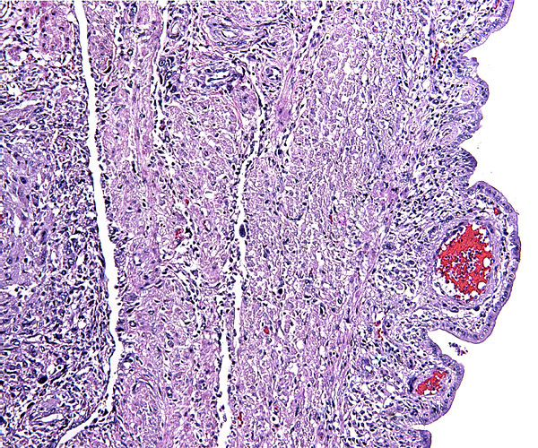 Endo-myometrium of pregnant coypu with some (dark) trophoblast infiltration.