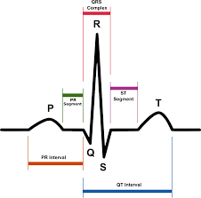 PQRST ecg wave