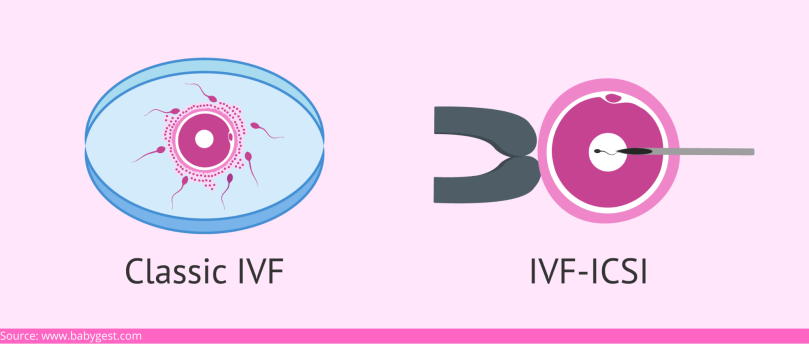 D:\Digicore\UNOSEARCH\Nisha IVF -Ahmedabad\Fertility Care\Source ivf-icsi-method.png