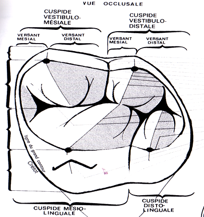 Reconstitution des cuspides dans la région molaire