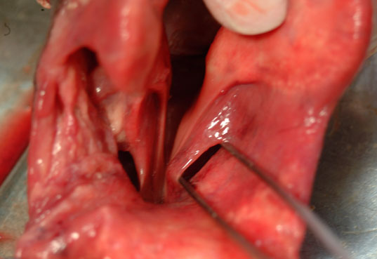 Photograph demonstrating the laryngeal saccule.