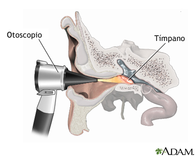 Examen otoscópico del oído