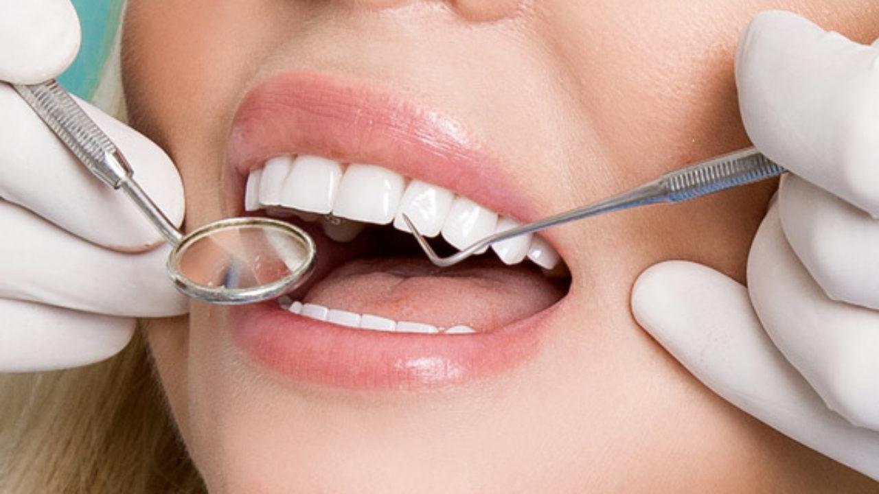 dental veneers in Newmarket