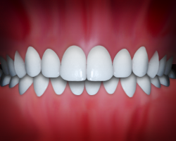 Common Bite Issues and How to Treat Them Lindsey Orthodontics