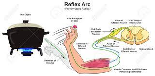 Reflex Arc Infographic Diagram With Example Of Polysynaptic Reflex Human  Hand Touching Hot Object Pain Receptors And Direction Of Impulse For  Medical Science Education Royalty Free Cliparts, Vectors, And Stock  Illustration. Image