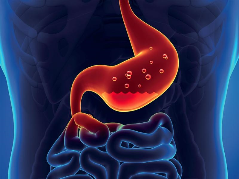 What Are The Symptoms of Low Stomach Acid?
