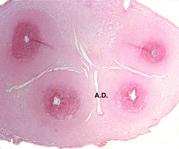 Sections of two different umbilical cords to show the slit-like allantoic duct (left) and the large duct with hanging blood vessels in the ductal space