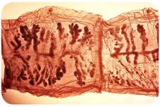 Organ morphology within Taenia solium tapeworm proglottids.
