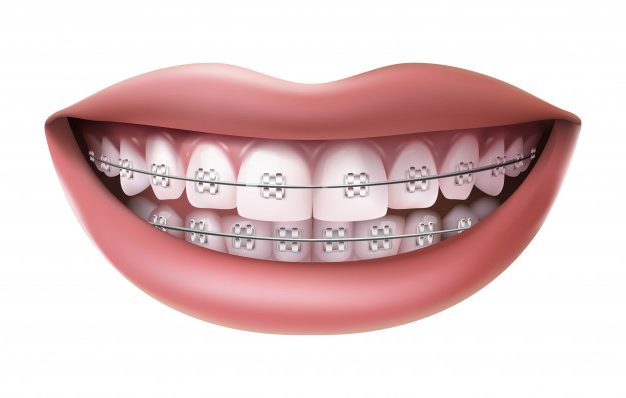 orthodontist in Newmarket