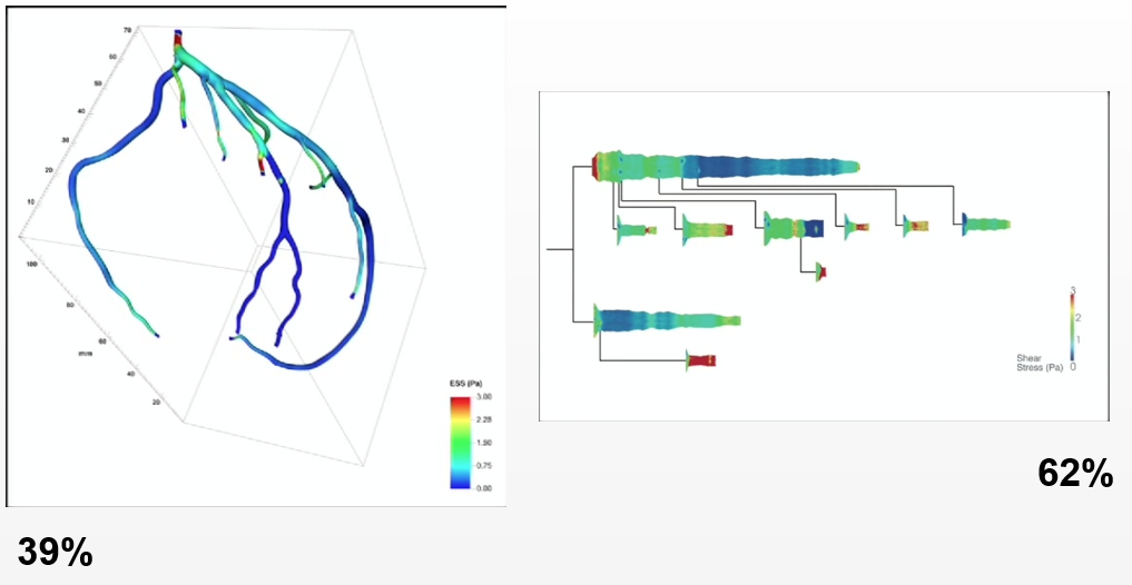 technological exaptation: cardio visualization adapted from galactic velocity visualization 