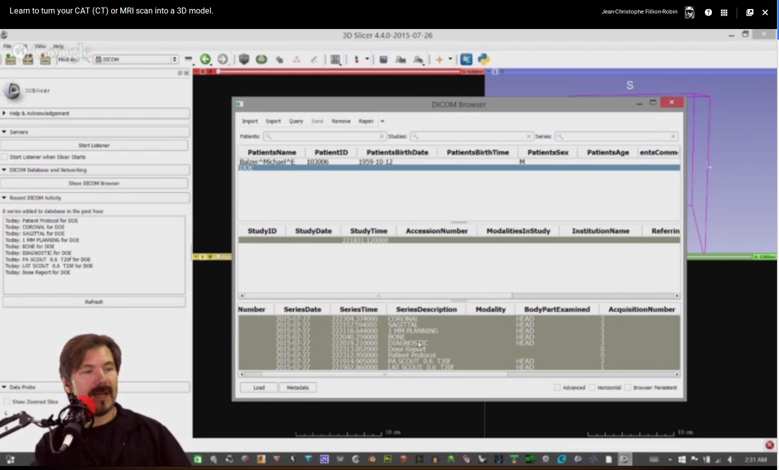 2015.07_3DSlicer-AllThings3D_podcast_LoadDICOM.png