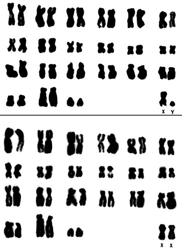 Karyotypes of male and female Presbytis entellus, 2n-44