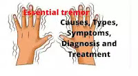 What Is Essential tremor
