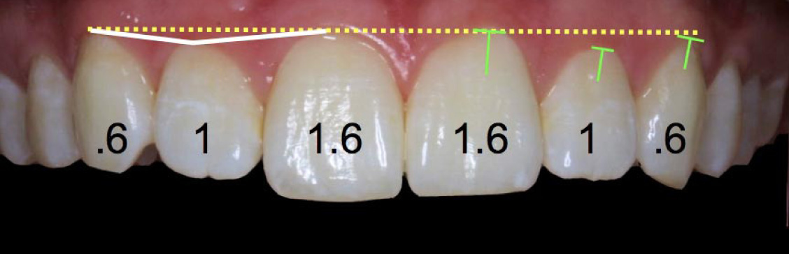Width to length ratio of your teeth. Generally the ratio is 80%