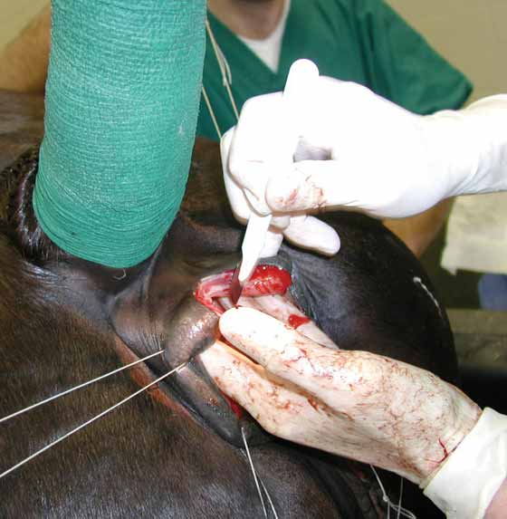 Pre-placed stay sutures at the 2-, 4-, 8-, and 10-o'clock positions before incising the rectal sphincter at the dorsal commissure.