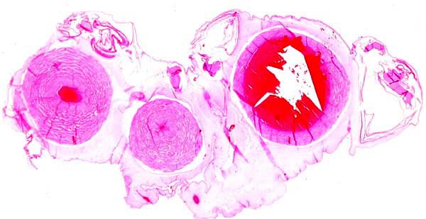 Umbilical cord of pygmy hippopotamus; vein at right