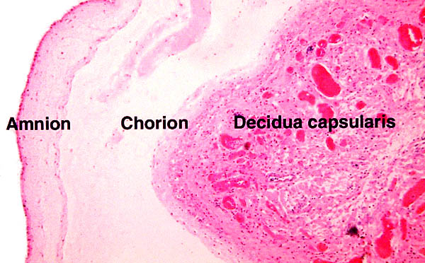 Fetal placental surface showing the loose attachment of the amnion to the chorion and the decidua capsularis and some extravillous trophoblast. As in other cercopithecidae, there are no atrophied villi as seen in human membranes