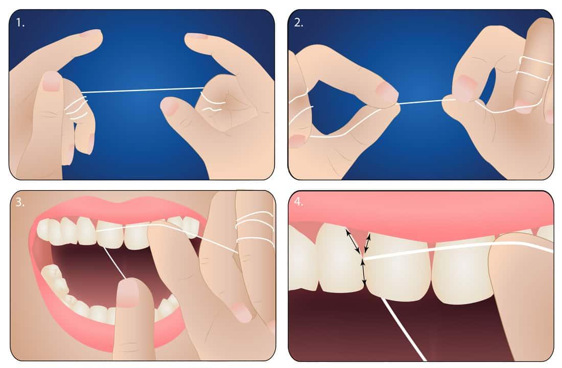 peregrination gå ind Rædsel How to Use Dental Floss - Bali Implant Aesthetic (BIA) Dental Center