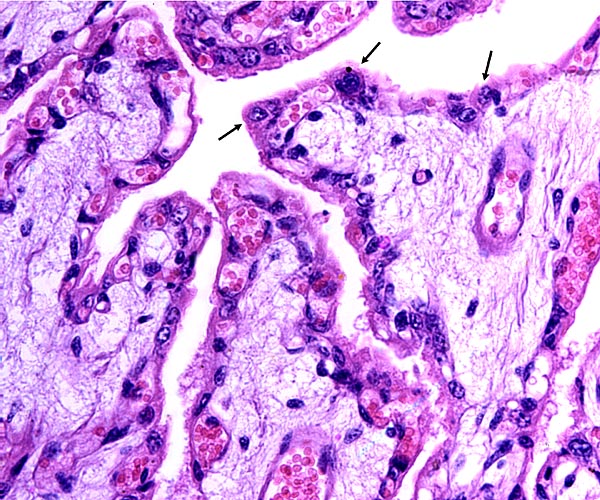 Mature Mhorr gazelle placental villi with binucleate cells at arrows. Note extensive interdigitation of fetal capillaries and cuboidal trophoblast