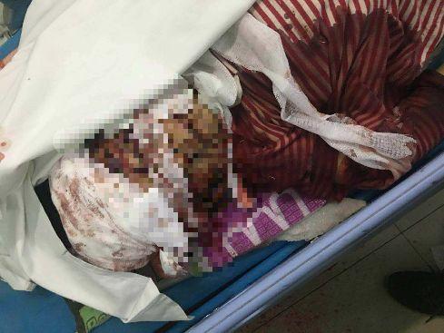 济南2名小孩校门口被砍致1死1伤 
